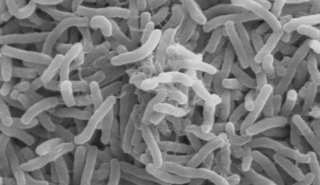 Violence is like Cholera: A Contagious Disease